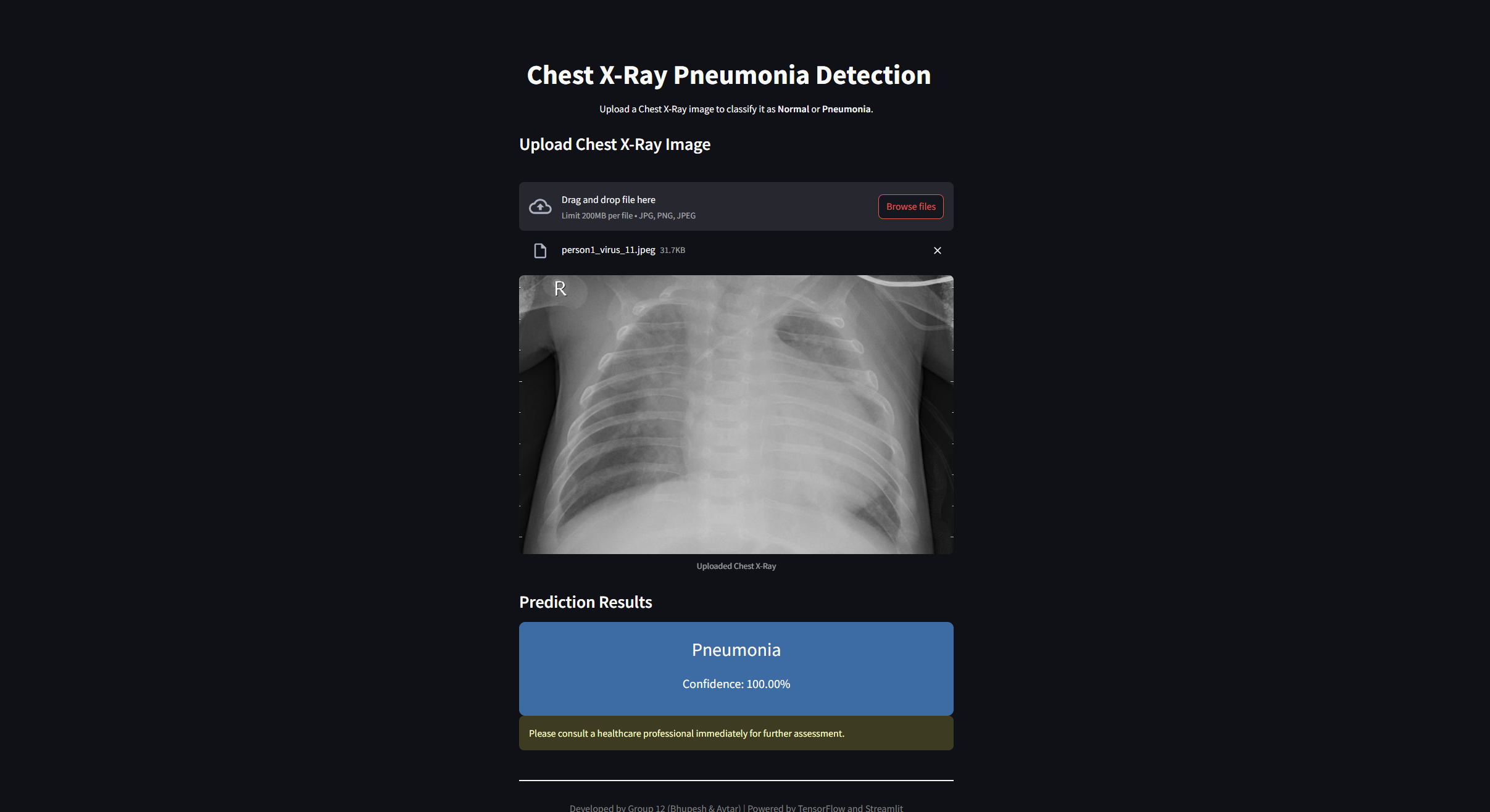 Pneumonia Detection App Preview